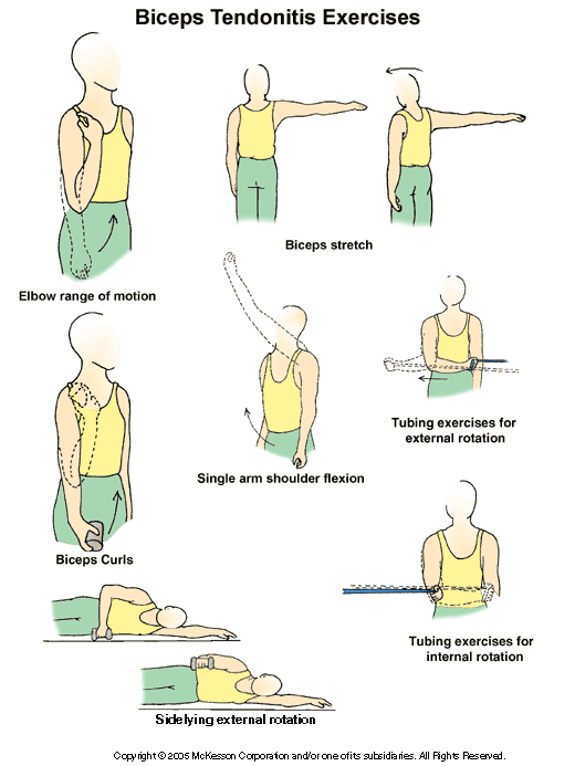 How To Rehab Elbow Tendonitis